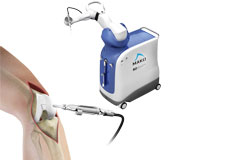 Mako Robotic-Arm Assisted  Partial Knee Replacement
